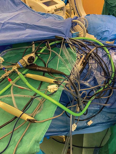 An operating room needing sterile drape for cord organization 
